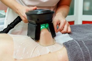 Deep Heat cellulite therapy